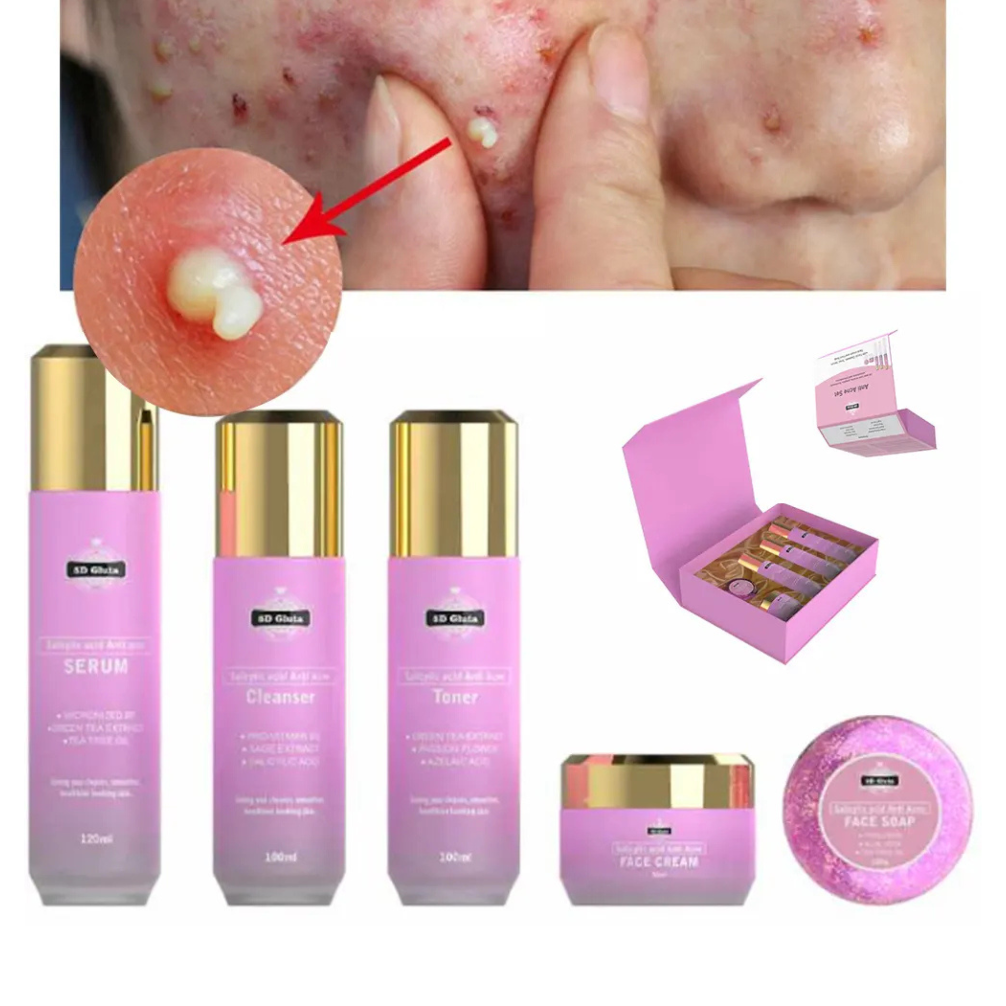 Clear Radiance Anti-Acne Serum Set